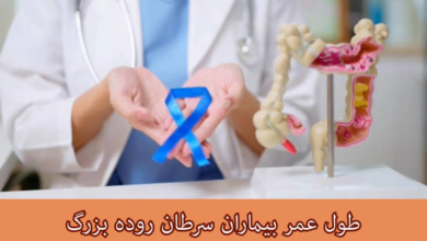 طول عمر بیماران سرطان روده بزرگ
